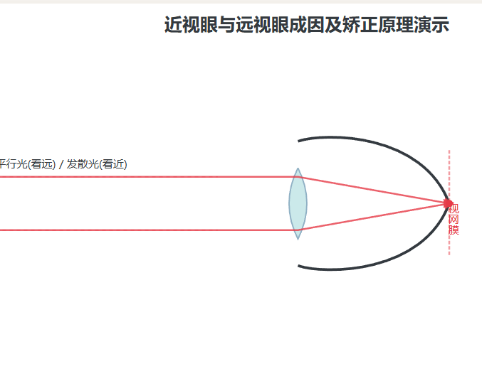 近视眼与远视眼成因及矫正原理